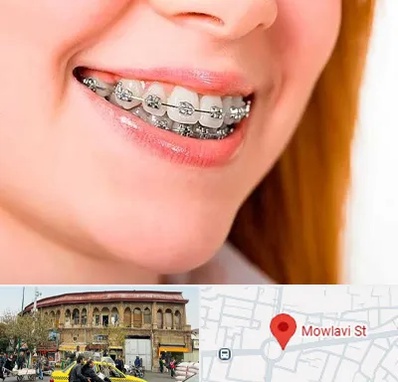 ارتودنسی ارزان در مولوی