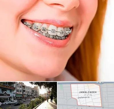 ارتودنسی ارزان در خیابان جمالزاده
