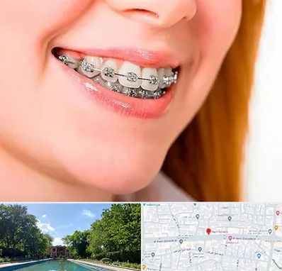 ارتودنسی ارزان در هشت بهشت اصفهان 