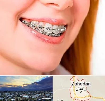ارتودنسی ارزان در زاهدان