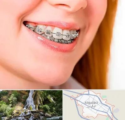 ارتودنسی ارزان در الیگودرز