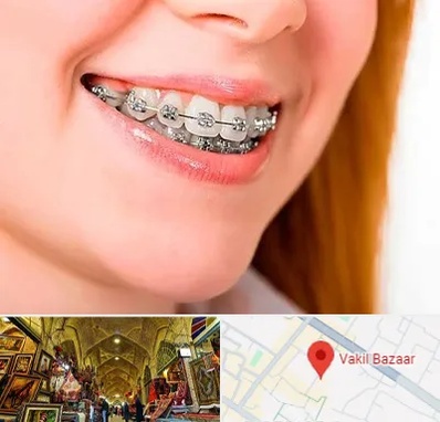 ارتودنسی ارزان در بازار وکیل شیراز