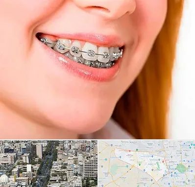 ارتودنسی ارزان در منطقه 18 تهران 
