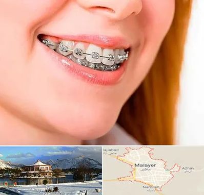ارتودنسی ارزان در ملایر