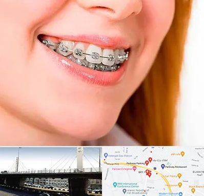 ارتودنسی ارزان در پارک وی 