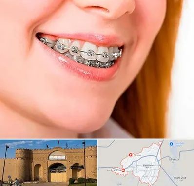 ارتودنسی ارزان در ایرانشهر