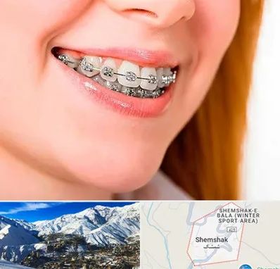 ارتودنسی ارزان در شمشک