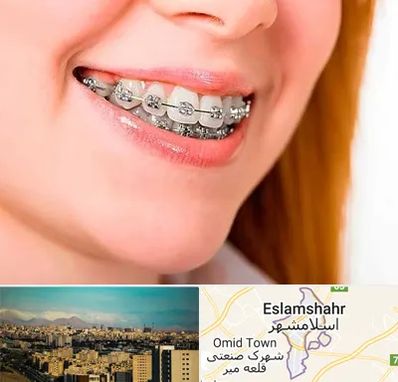 ارتودنسی ارزان در اسلامشهر