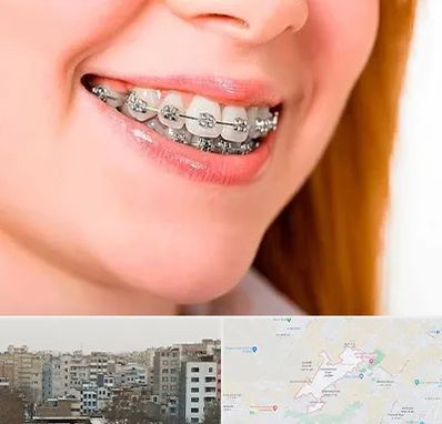 ارتودنسی ارزان در محمد شهر کرج 