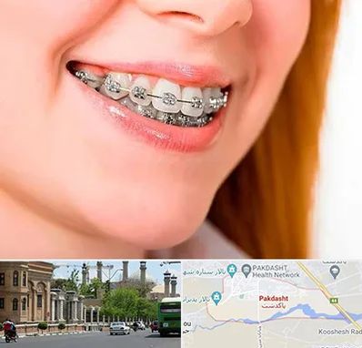 ارتودنسی ارزان در پاکدشت
