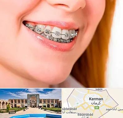 ارتودنسی ارزان در کرمان