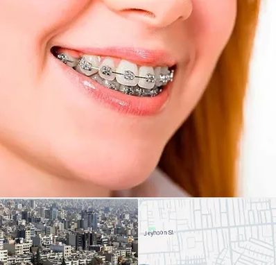 ارتودنسی ارزان در جیحون