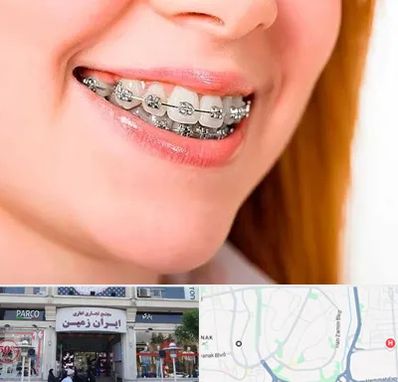 ارتودنسی ارزان در ایران زمین