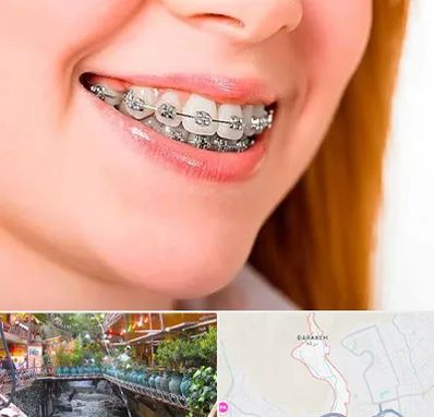 ارتودنسی ارزان در درکه