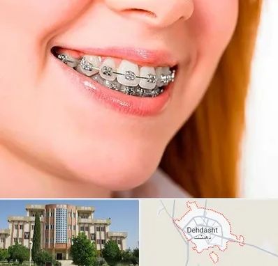 ارتودنسی ارزان در دهدشت