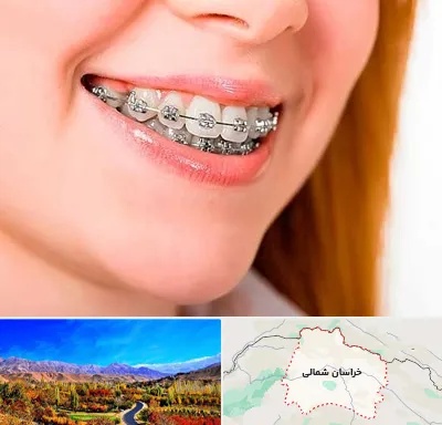 ارتودنسی ارزان در خراسان شمالی