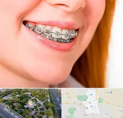 ارتودنسی ارزان در کاشمر