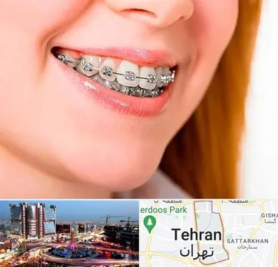 ارتودنسی ارزان در صادقیه 