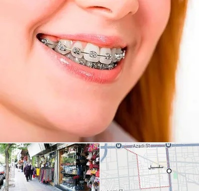 ارتودنسی ارزان در سلسبیل