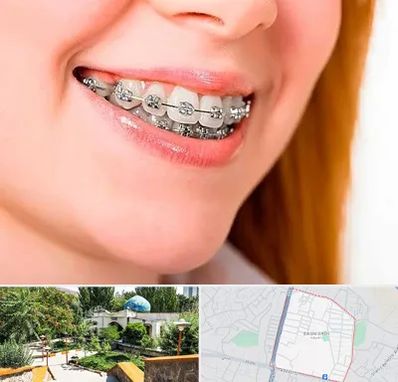 ارتودنسی ارزان در باغمیشه تبریز