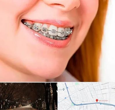 ارتودنسی ارزان در ابوریحان تبریز