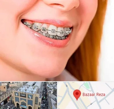 ارتودنسی ارزان در بازار رضا مشهد