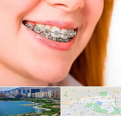 ارتودنسی ارزان در منطقه 22 تهران 