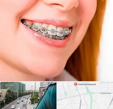 ارتودنسی ارزان در بلوار فرحزادی