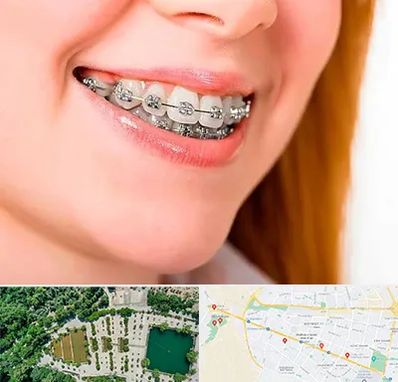 ارتودنسی ارزان در وکیل آباد مشهد 