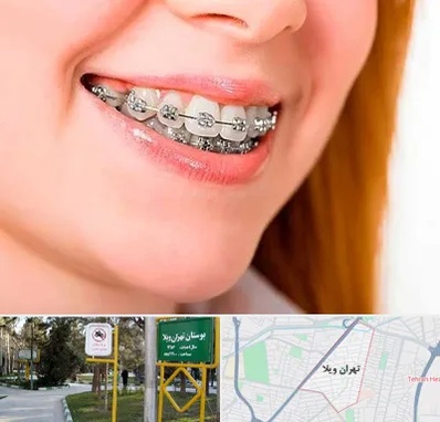 ارتودنسی ارزان در تهران ویلا