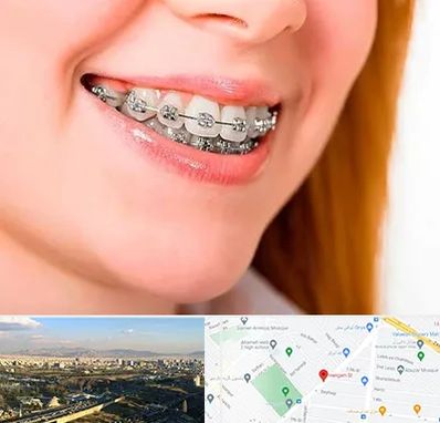 ارتودنسی ارزان در هنگام 