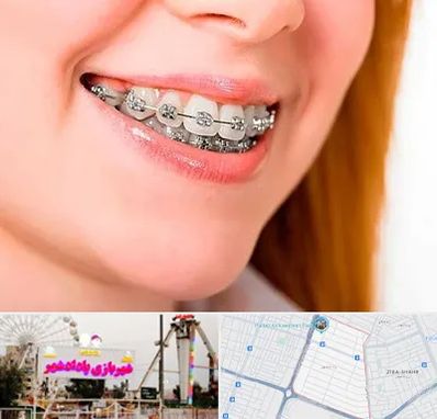 ارتودنسی ارزان در پادادشهر اهواز