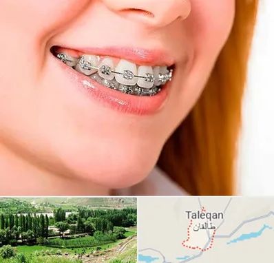 ارتودنسی ارزان در طالقان