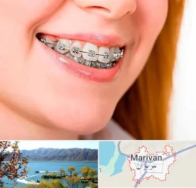 ارتودنسی ارزان در مریوان