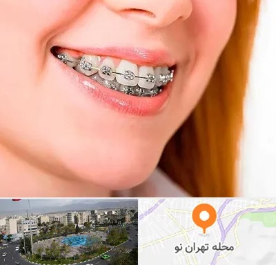ارتودنسی ارزان در تهران نو