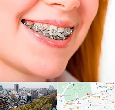 ارتودنسی ارزان در بلوار کشاورز 