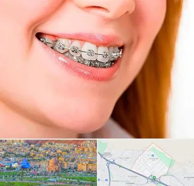 ارتودنسی ارزان در رشدیه تبریز