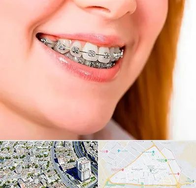 ارتودنسی ارزان در قاسم آباد مشهد 