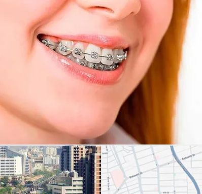 ارتودنسی ارزان در خیابان بهشتی