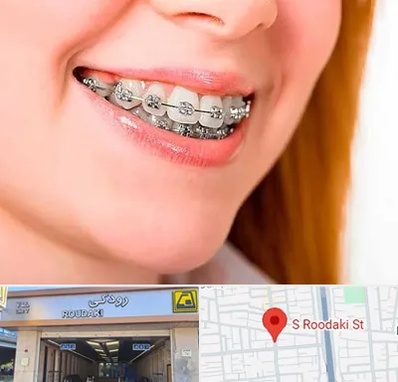 ارتودنسی ارزان در رودکی
