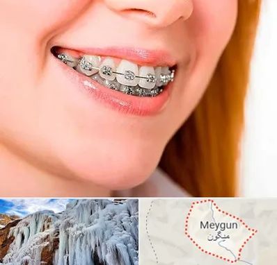 ارتودنسی ارزان در میگون