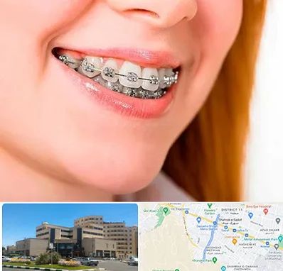 ارتودنسی ارزان در صیاد شیرازی مشهد 