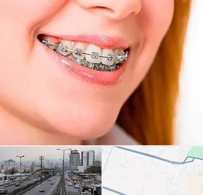 ارتودنسی ارزان در بلوار ارتش