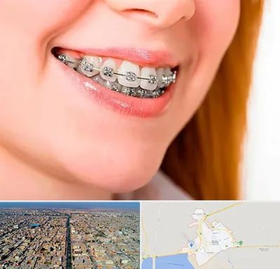 ارتودنسی ارزان در بندر ماهشهر