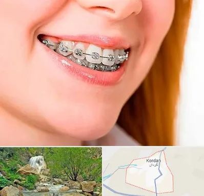 ارتودنسی ارزان در کردان