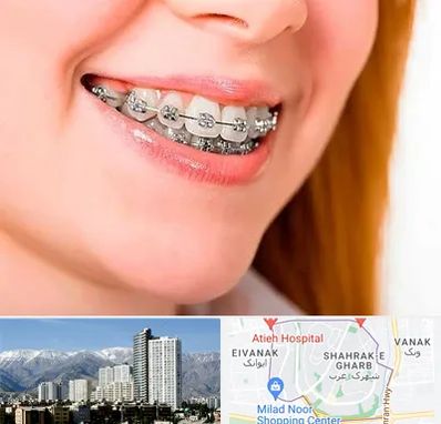 ارتودنسی ارزان در شهرک غرب 