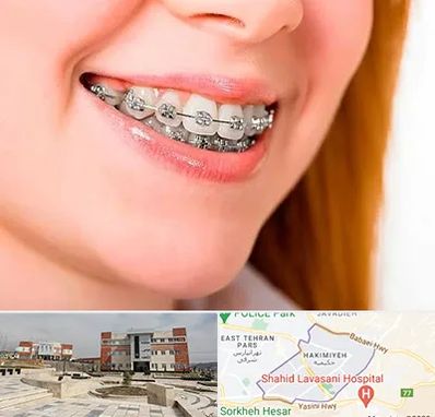 ارتودنسی ارزان در حکیمیه 