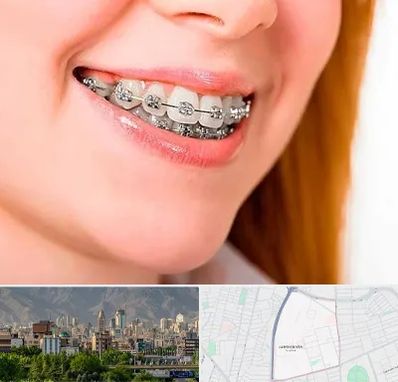 ارتودنسی ارزان در جمشیدیه