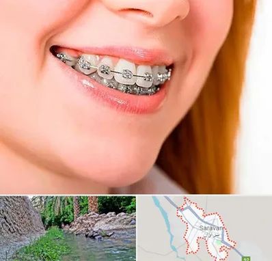 ارتودنسی ارزان در سراوان