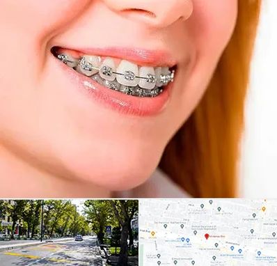 ارتودنسی ارزان در میرداماد 